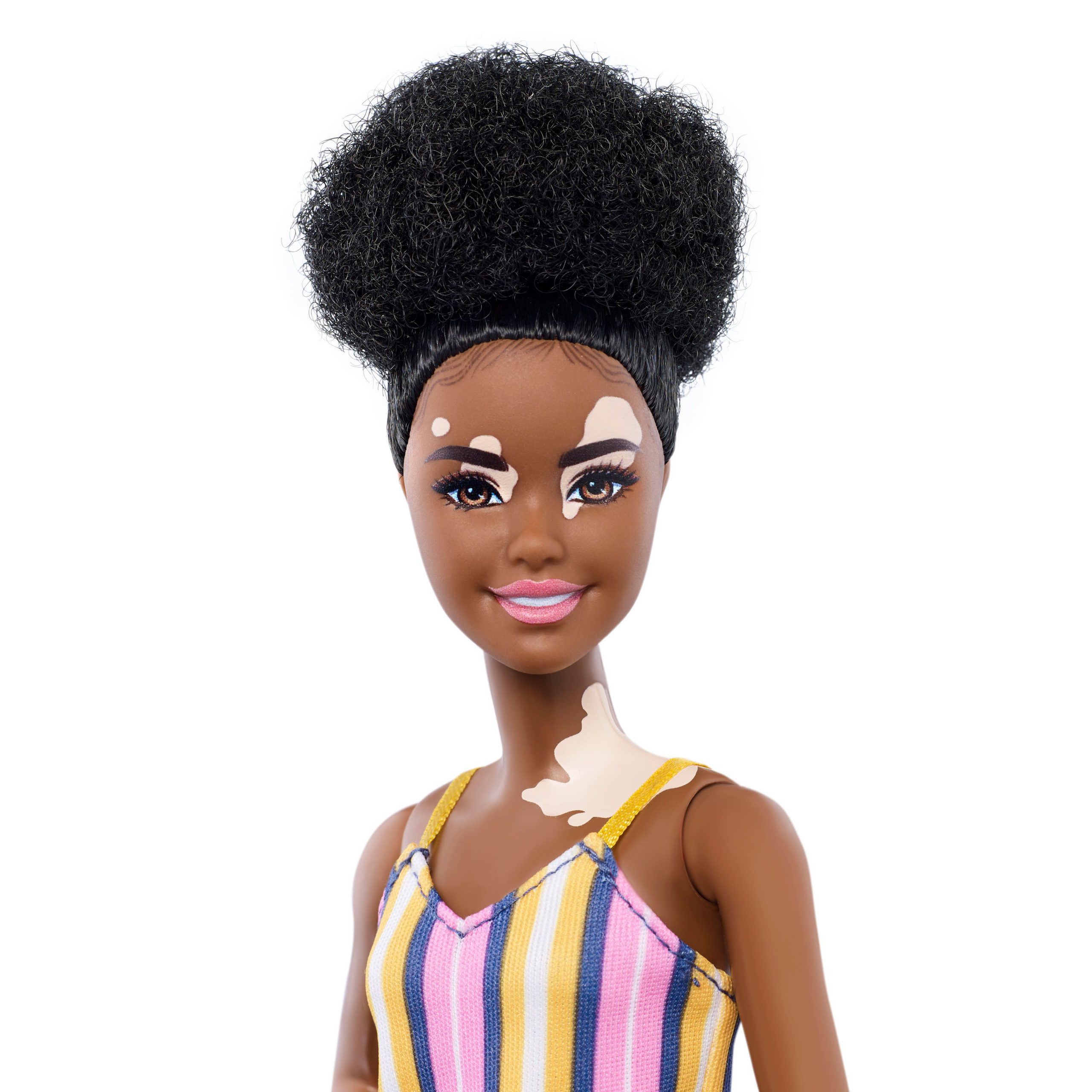  Barbie will now sell a version that looks as if it has the skin condition vitiligo